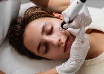 Foto de una persona limpiandose el rostro con un proceso dermatológico