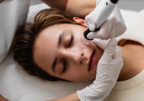 Foto de una persona limpiandose el rostro con un proceso dermatológico