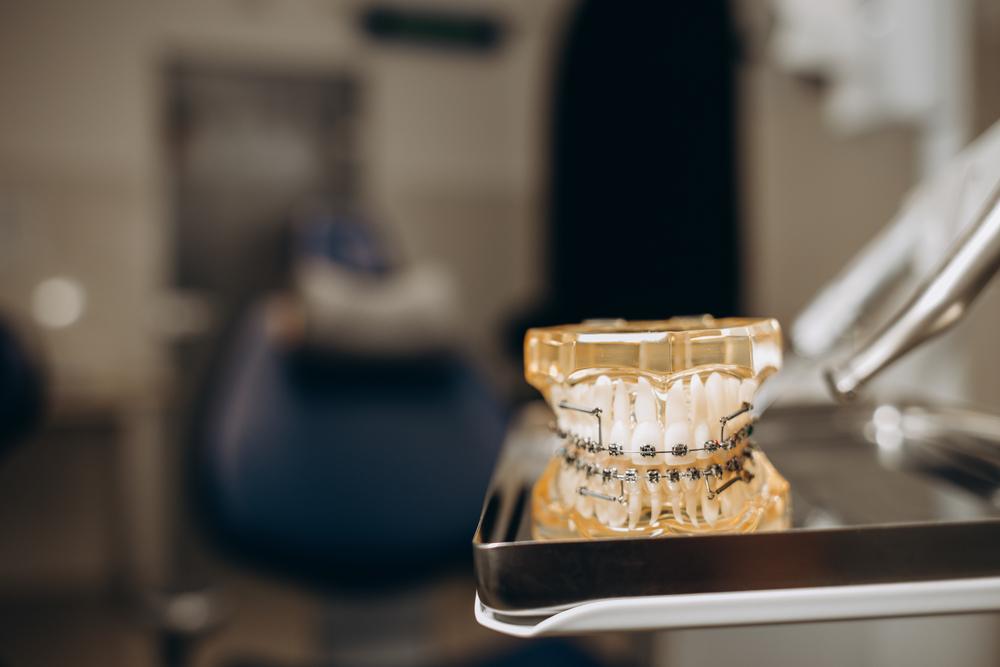 Foto de una protesis dental sobre una bandeja